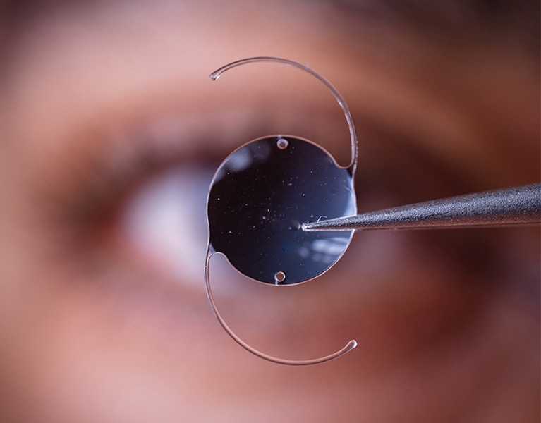 An intraocular lens